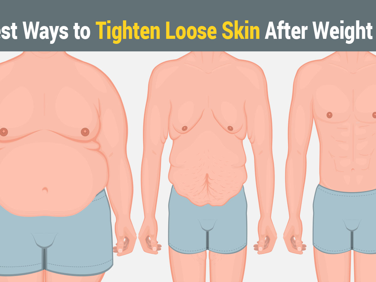 Featured image of post How To Tighten Loose Skin On Stomach After Weight Loss