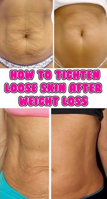 Featured image of post How To Tighten Loose Skin On Stomach With Exercise